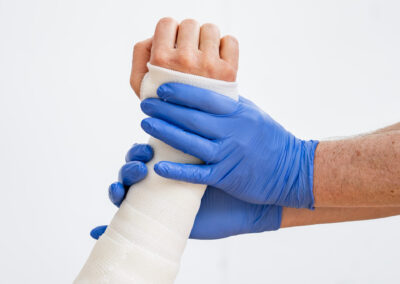 Arm gipsen